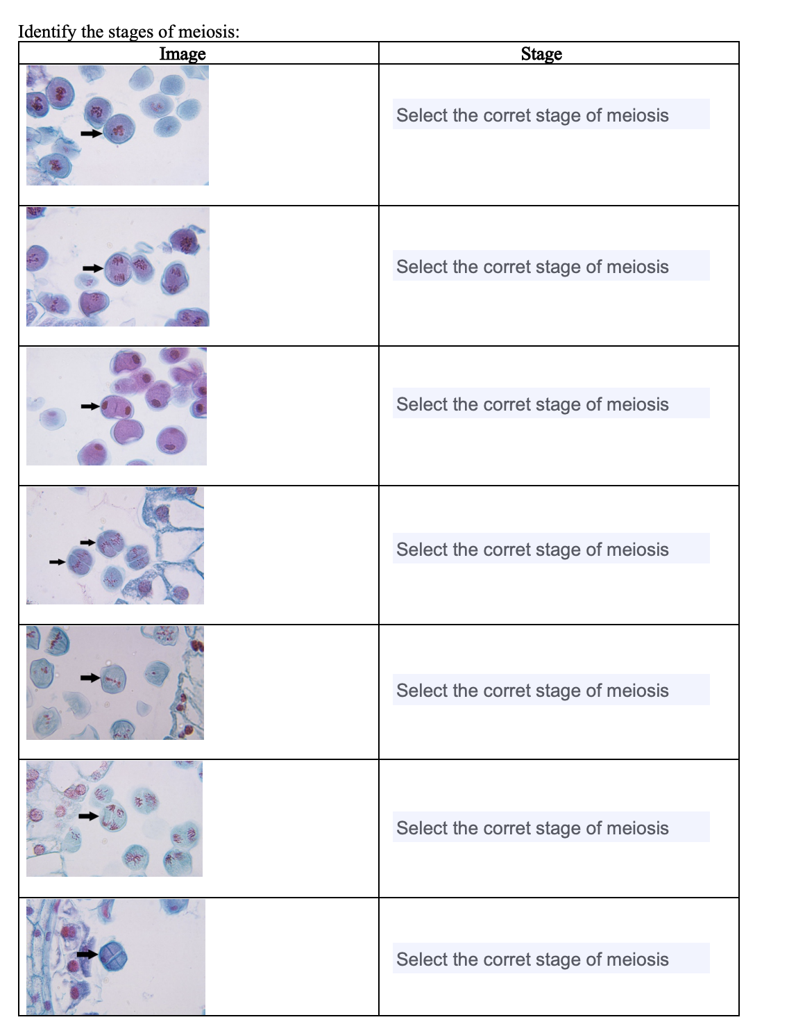 Identify the stages of meiosis:
Image
Stage
Select the corret stage of meiosis
Select the corret stage of meiosis
Select the corret stage of meiosis
Select the corret stage of meiosis
Select the corret stage of meiosis
Select the corret stage of meiosis
Select the corret stage of meiosis