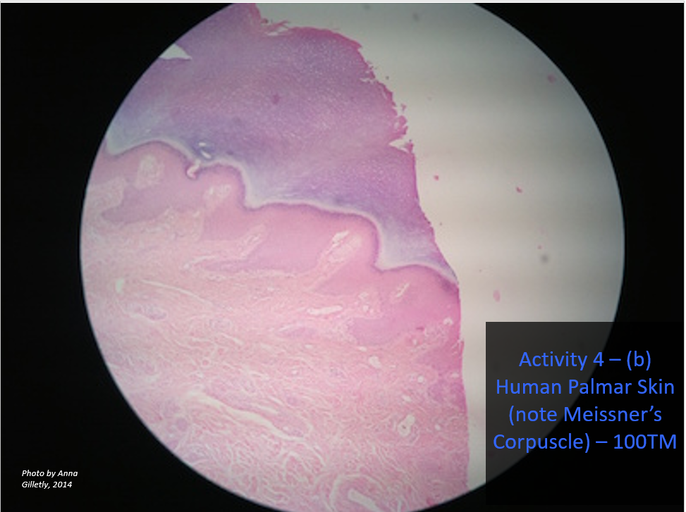Activity 4 – (b)
Human Palmar Skin
(note Meissner's
Corpuscle) – 10OTM
Photo by Anna
Gilletly, 2014
